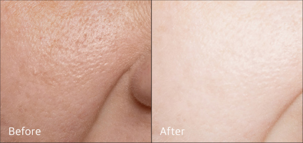 Vegansk toner, ris toner Risvand toner, koreansk ansigtstoner Naturlig toner,toner uden parfume Fugtgivende toner,toner med aloe vera Hyaluronsyre toner, AHA PHA toner Toner til sensitiv hud, opstrammende toner Lysnende toner, porerensende toner Toner mod tør hud Økologisk risvand toner Vegansk hudpleje toner Vegansk K-beauty toner Toner til alle hudtyper Mild ansigtstoner Rense toner til ansigtet Toner mod uren hud Toner mod ru hud Toner uden syntetiske dufte Toner tiltræt hud Toner mod pigmentpletter Koreansk hudpleje til ansigt Vegansk skønhedspleje toner Fugtbooster toner