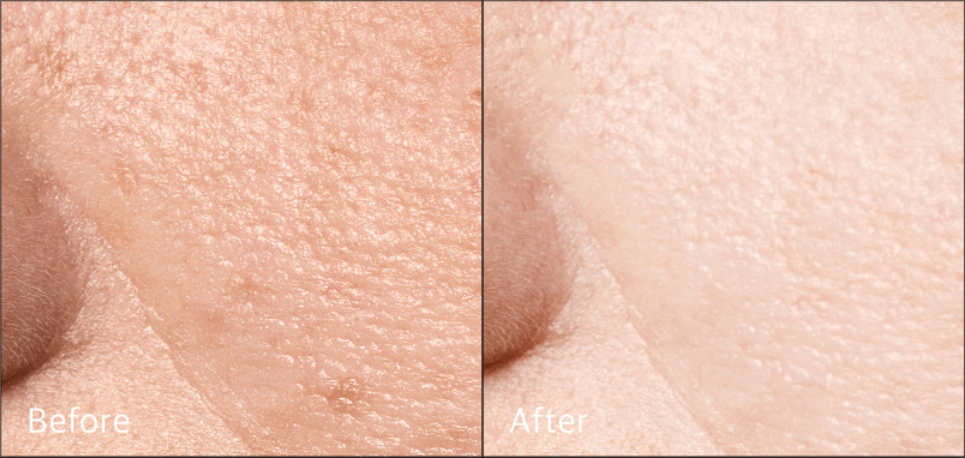 Vegansk toner, ris toner Risvand toner, koreansk ansigtstoner Naturlig toner,toner uden parfume Fugtgivende toner,toner med aloe vera Hyaluronsyre toner, AHA PHA toner Toner til sensitiv hud, opstrammende toner Lysnende toner, porerensende toner Toner mod tør hud Økologisk risvand toner Vegansk hudpleje toner Vegansk K-beauty toner Toner til alle hudtyper Mild ansigtstoner Rense toner til ansigtet Toner mod uren hud Toner mod ru hud Toner uden syntetiske dufte Toner tiltræt hud Toner mod pigmentpletter Koreansk hudpleje til ansigt Vegansk skønhedspleje toner Fugtbooster toner